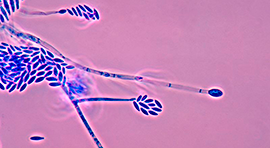 Biotika Gober para tratar Pudriciones